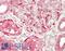 Serologically defined colon cancer antigen 3 antibody, LS-B14801, Lifespan Biosciences, Immunohistochemistry paraffin image 