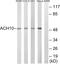 Cholinergic Receptor Nicotinic Alpha 10 Subunit antibody, LS-B9850, Lifespan Biosciences, Western Blot image 