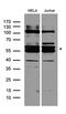 Fanconi anemia group E protein antibody, A07604-1, Boster Biological Technology, Western Blot image 