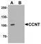 Cyclin T1 antibody, TA319625, Origene, Western Blot image 