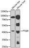 Prostacyclin receptor antibody, A1849, ABclonal Technology, Western Blot image 