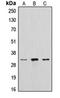 Lysosomal protective protein antibody, orb214425, Biorbyt, Western Blot image 