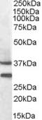 Melanocortin receptor 5 antibody, EB08447, Everest Biotech, Western Blot image 