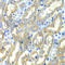 DEAD-Box Helicase 1 antibody, A6575, ABclonal Technology, Immunohistochemistry paraffin image 