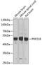 PHD Finger Protein 21B antibody, A16476, Boster Biological Technology, Western Blot image 