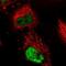 DEAD-Box Helicase 5 antibody, NBP1-83406, Novus Biologicals, Immunocytochemistry image 