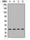 HERV-FRD_6p24.1 provirus ancestral Env polyprotein antibody, orb411682, Biorbyt, Western Blot image 