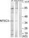 5'-Nucleotidase, Cytosolic IIIA antibody, A30559, Boster Biological Technology, Western Blot image 