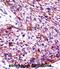 Keratin 6C antibody, abx027868, Abbexa, Immunohistochemistry paraffin image 