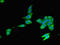 Zinc Finger FYVE-Type Containing 26 antibody, orb400296, Biorbyt, Immunocytochemistry image 