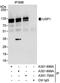 Ubiquitin Specific Peptidase 1 antibody, A301-698A, Bethyl Labs, Immunoprecipitation image 