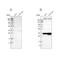 Signal Sequence Receptor Subunit 1 antibody, PA5-53542, Invitrogen Antibodies, Western Blot image 