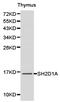 SH2 Domain Containing 1A antibody, TA326947, Origene, Western Blot image 