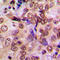 Metastasis Associated 1 antibody, abx133152, Abbexa, Western Blot image 