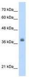 LIM Domain Binding 1 antibody, TA331479, Origene, Western Blot image 
