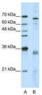 Serine And Arginine Rich Splicing Factor 1 antibody, TA345990, Origene, Western Blot image 