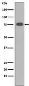 Vitronectin antibody, M02271, Boster Biological Technology, Western Blot image 