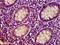 Thiosulfate Sulfurtransferase antibody, LS-C672704, Lifespan Biosciences, Immunohistochemistry paraffin image 