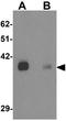 Potassium Two Pore Domain Channel Subfamily K Member 12 antibody, GTX31840, GeneTex, Western Blot image 