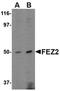 Fasciculation And Elongation Protein Zeta 2 antibody, orb74915, Biorbyt, Western Blot image 