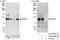 CD265 antibody, A303-807A, Bethyl Labs, Western Blot image 