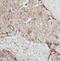 Epidermal Growth Factor Receptor Pathway Substrate 8 antibody, FNab02819, FineTest, Immunohistochemistry frozen image 