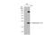 Enterovirus antibody, GTX630191, GeneTex, Western Blot image 