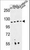 RPGR Interacting Protein 1 antibody, LS-C162692, Lifespan Biosciences, Western Blot image 