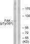 PTK2 antibody, TA312491, Origene, Western Blot image 