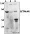 SET Domain And Mariner Transposase Fusion Gene antibody, A04944, Boster Biological Technology, Western Blot image 