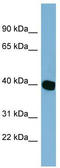 NADP Dependent Oxidoreductase Domain Containing 1 antibody, TA340305, Origene, Western Blot image 