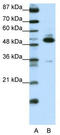 Transcriptional Adaptor 3 antibody, TA343603, Origene, Western Blot image 