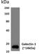 Galectin 1 antibody, GTX53170, GeneTex, Western Blot image 