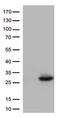 Cancer/Testis Antigen 1B antibody, CF505952, Origene, Western Blot image 