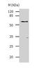 Aldehyde Dehydrogenase 1 Family Member A1 antibody, TA321183, Origene, Western Blot image 