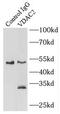 Voltage Dependent Anion Channel 3 antibody, FNab09389, FineTest, Immunoprecipitation image 