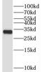 TP53 Regulated Inhibitor Of Apoptosis 1 antibody, FNab08964, FineTest, Western Blot image 