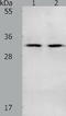 NME/NM23 Nucleoside Diphosphate Kinase 6 antibody, TA322558, Origene, Western Blot image 