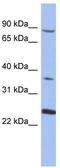 Membrane Palmitoylated Protein 3 antibody, TA337653, Origene, Western Blot image 