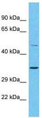 Olfactory Receptor Family 2 Subfamily A Member 25 antibody, TA337487, Origene, Western Blot image 