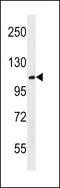 Methyl-CpG Binding Domain Protein 6 antibody, 60-195, ProSci, Western Blot image 