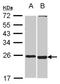 Spermatogenesis And Oogenesis Specific Basic Helix-Loop-Helix 2 antibody, NBP2-20453, Novus Biologicals, Western Blot image 
