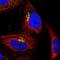 Conserved oligomeric Golgi complex subunit 5 antibody, NBP2-58968, Novus Biologicals, Immunocytochemistry image 