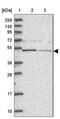 Glucose-Fructose Oxidoreductase Domain Containing 2 antibody, NBP1-82066, Novus Biologicals, Western Blot image 