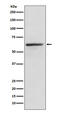 KLC1 antibody, M04116, Boster Biological Technology, Western Blot image 