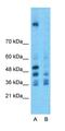 Zinc Finger E-Box Binding Homeobox 2 antibody, orb329735, Biorbyt, Western Blot image 