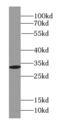 Syndecan Binding Protein antibody, FNab08458, FineTest, Western Blot image 