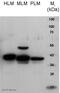 Hydroxysteroid 11-Beta Dehydrogenase 1 antibody, ab83522, Abcam, Western Blot image 