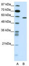 Nuclear Receptor Subfamily 1 Group D Member 2 antibody, TA343508, Origene, Western Blot image 