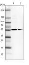 DENN Domain Containing 6B antibody, NBP1-81110, Novus Biologicals, Western Blot image 